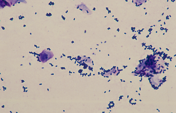 Otite externa: uma colheita adequada é fundamental para o diagnóstico.